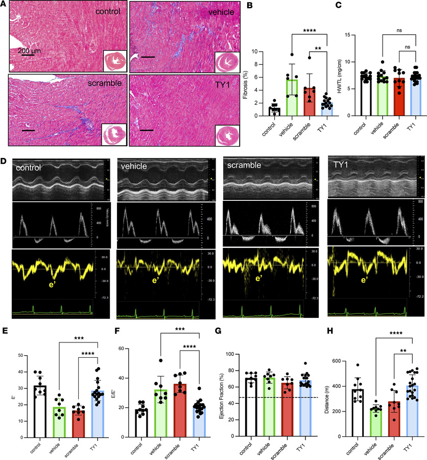 Hearts of mice fed TY1 exhibit antifibrotic effects and attenuation of d...