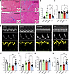 Hearts of mice fed TY1 exhibit antifibrotic effects and attenuation of dias