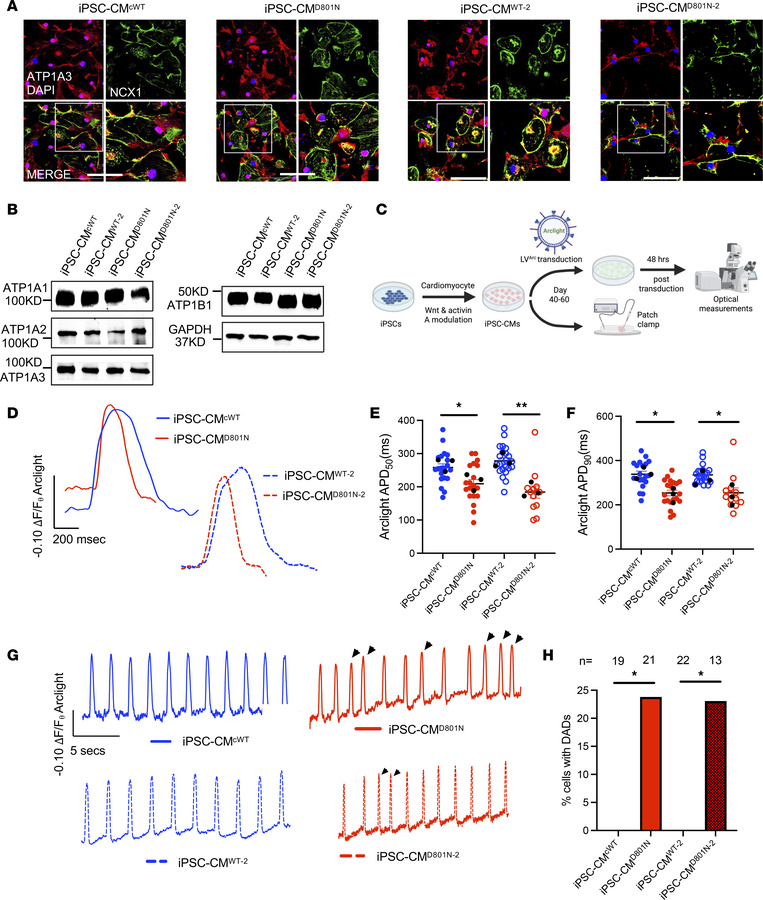 iPSC-CMD801N have shortened APD and delayed afterdepolarizations.
(A) Re...
