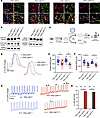 iPSC-CMD801N have shortened APD and delayed afterdepolarizations.