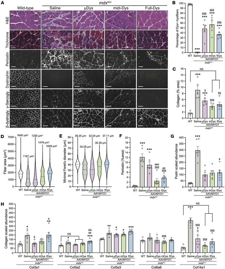Histology analysis of gastrocnemius muscle cross sections showing improv...