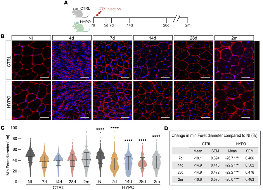 Skeletal muscle regeneration after injury: hypothyroid versus control.
(...