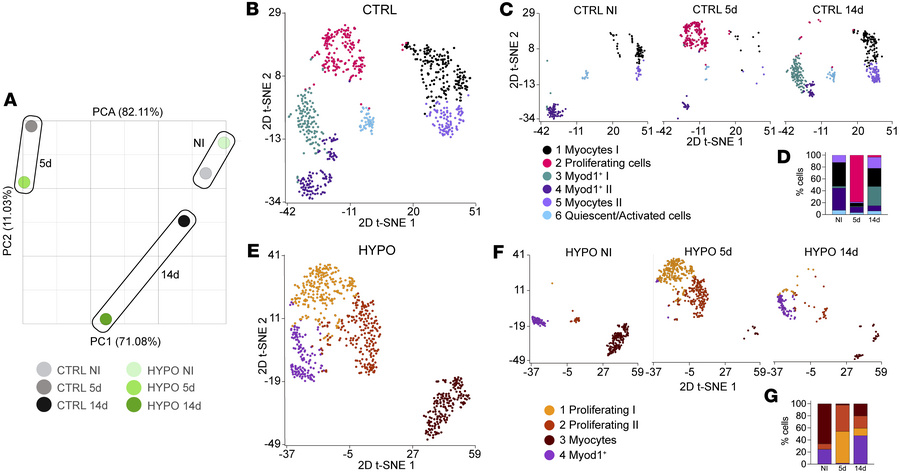 Hypothyroidism alters transcriptional profiles, cellular composition, an...