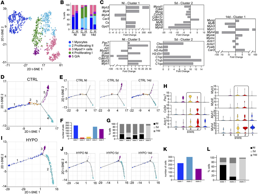 scRNA-seq and trajectory analysis reveal altered myogenic cell state tra...