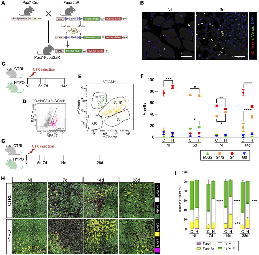 Hypothyroidism impairs muscle stem cell cycle progression and fiber type...