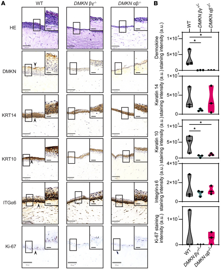 Staining of DMKN-KO and WT 3D organotypic skin cultures shows changes in...