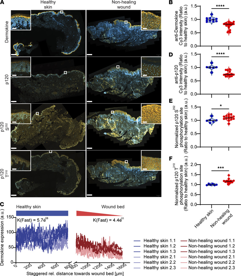 Dermokine expression decreases and p120 phosphorylation increases in ker...