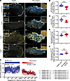 Dermokine expression decreases and p120 phosphorylation increases in kerati