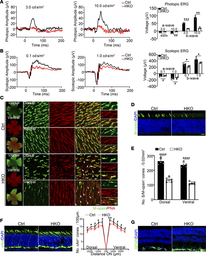 
Virma depletion in cone cells leads to cone defects in the retina.
(A) ...