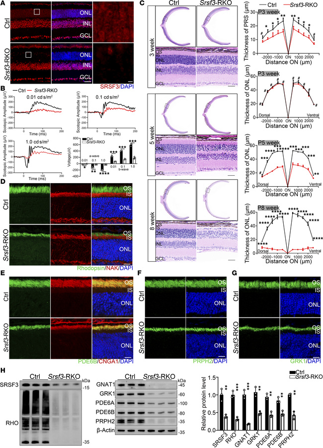 
SRSF3-mediated alternative splicing is crucial for retina function.
(A)...