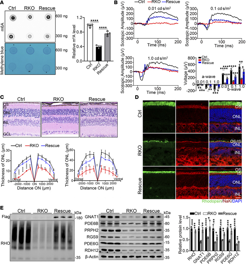 Replenishing Virma can attenuate photoreceptor degeneration in RKO mice....