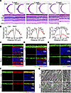 Virma deficiency leads to progressive rod cell loss in the retina.
