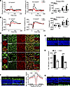 Virma depletion in cone cells leads to cone defects in the retina.