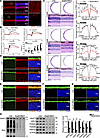 SRSF3-mediated alternative splicing is crucial for retina function.