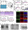 Replenishing Virma can attenuate photoreceptor degeneration in RKO mice.