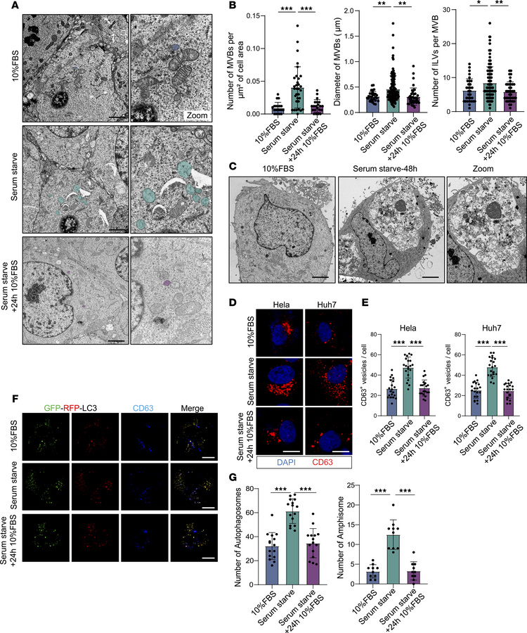 Serum starvation induces ILV budding and MVB biogenesis in tumor cells.
...
