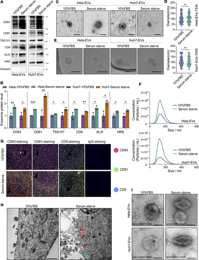 Serum starvation induces EVs secretion.
(A) Western blot analysis of EV ...