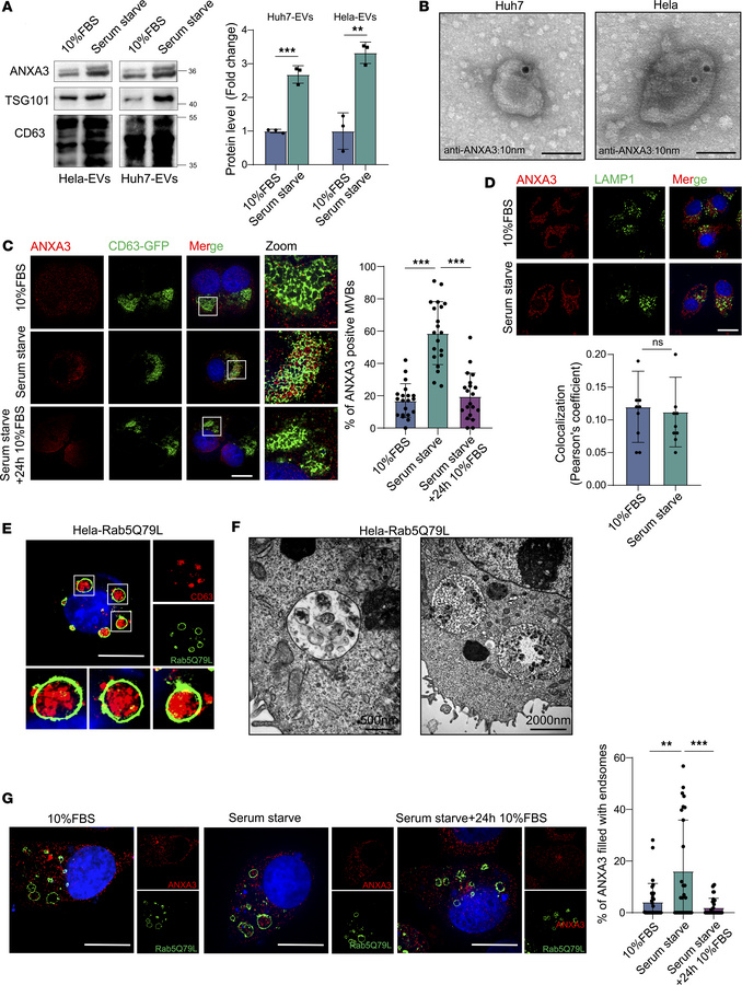 ANXA3 is enriched in starvation-induced EVs.
(A) Western blot analysis o...