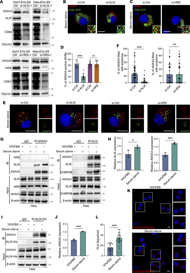 Sorting of ANXA3 into MVB is dependent on ALIX.
(A) Western blot analysi...