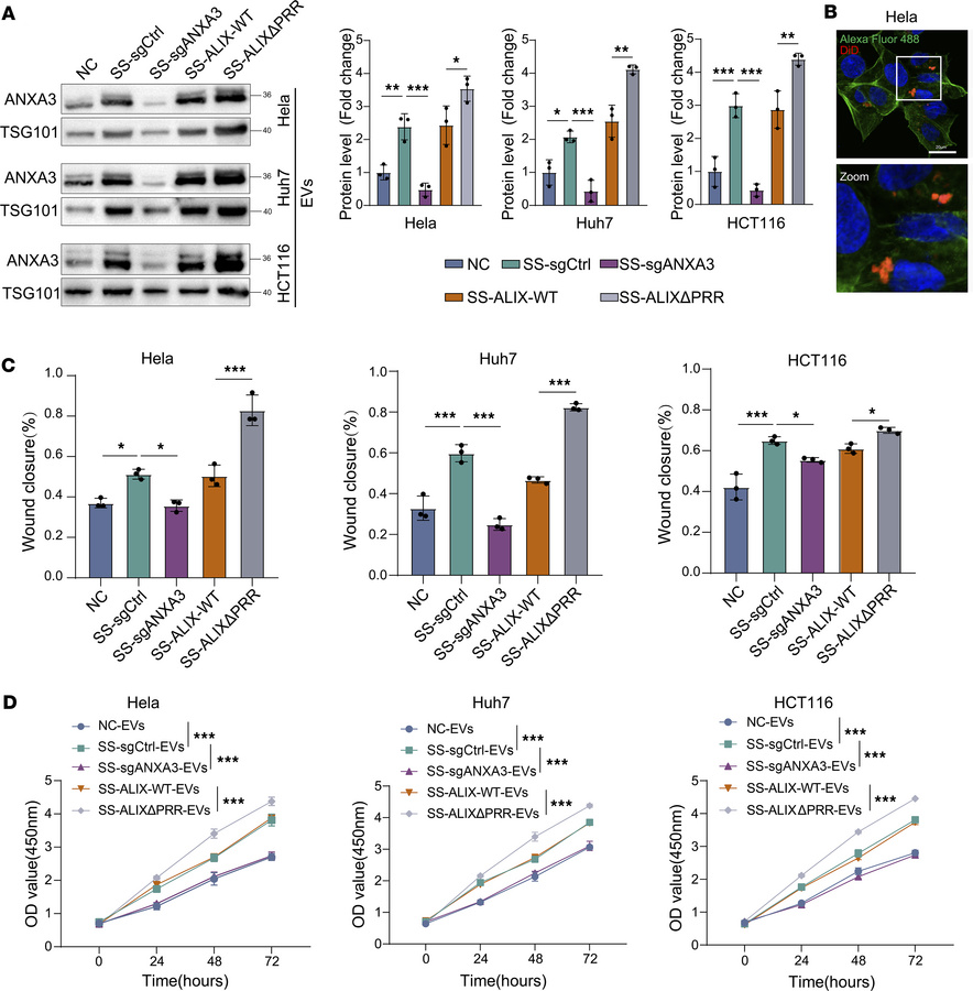 ANXA3+ EVs promote tumor cell migration and proliferation.
(A) Western b...