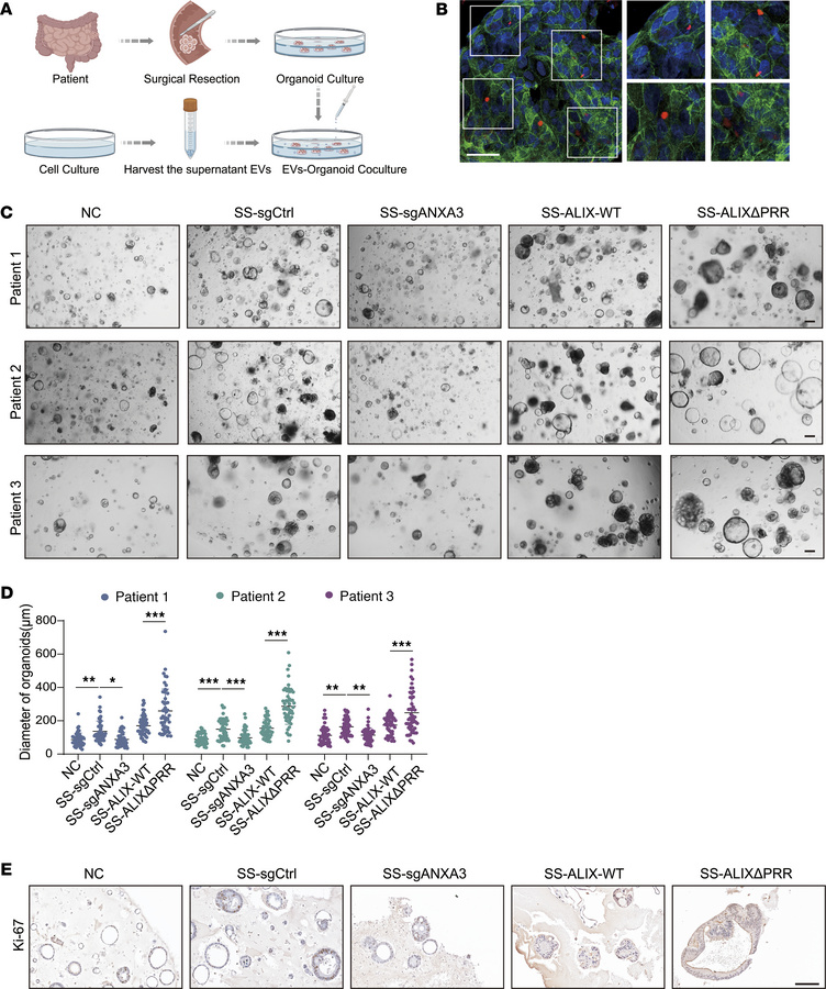ANXA3+ EVs promote the growth of CRC organoids.
(A) Schematic of organoi...