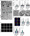 Serum starvation induces ILV budding and MVB biogenesis in tumor cells.