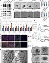 Serum starvation induces EVs secretion.
