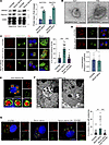 ANXA3 is enriched in starvation-induced EVs.
