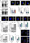 Sorting of ANXA3 into MVB is dependent on ALIX.