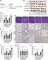 ANXA3+ EVs promote s.c. tumor growth in mice.