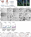 ANXA3+ EVs promote the growth of CRC organoids.