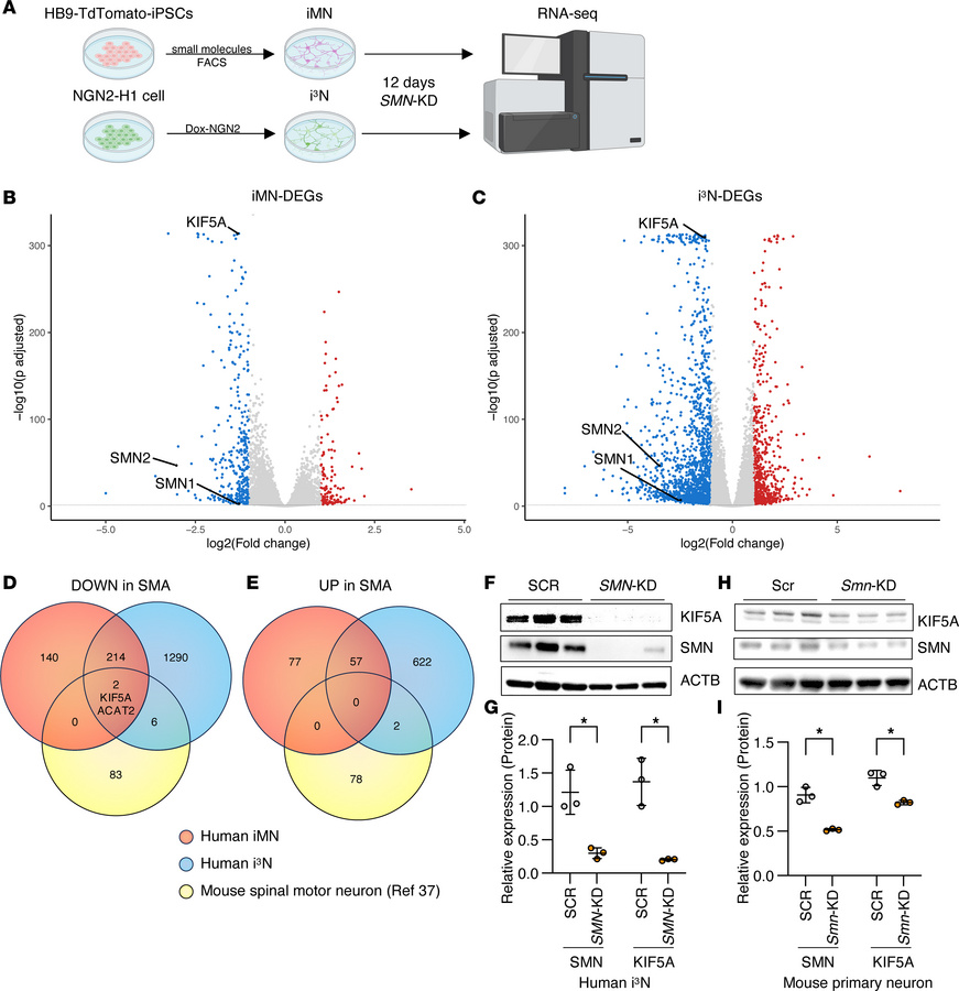 SMN deficiency downregulates KIF5A expression.
(A) Two types of human ne...