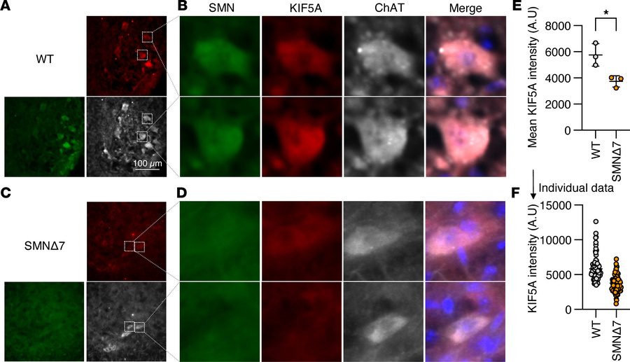 KIF5A is downregulated in SMA model mice.
(A–D) IHC analysis of whole sp...