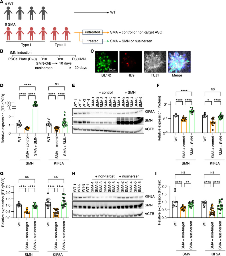 KIF5A is downregulated in SMA patient–derived iPSC motor neurons.
(A–C) ...