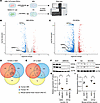 SMN deficiency downregulates KIF5A expression.