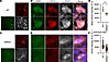 KIF5A is downregulated in SMA model mice.