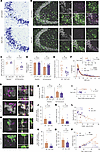 SWELL1 deletion confers paradoxical neuroprotection after seizures due to r