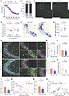 Female SWELL1 cKO mice exhibit neuroprotection without increased seizure se