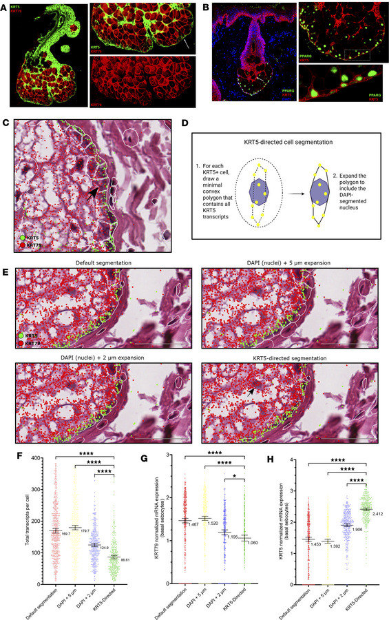 Sebaceous gland microanatomy and evaluation of different segmentation ap...