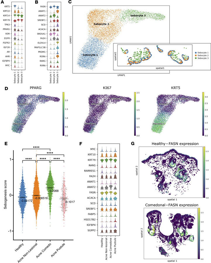 Sebaceous gland spatial transcriptomics analysis.
(A) Subclustering on p...