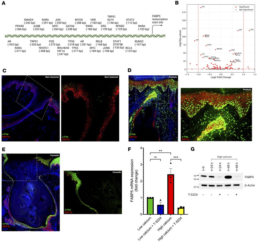 Regulation of FABP5 in human keratinocytes.
(A) Schematic of transcripti...