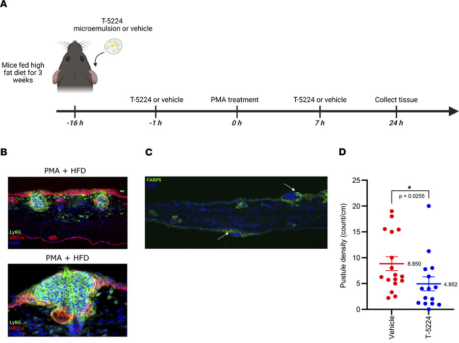 AP-1 inhibition reduces abscess formation in a mouse model of neutrophil...