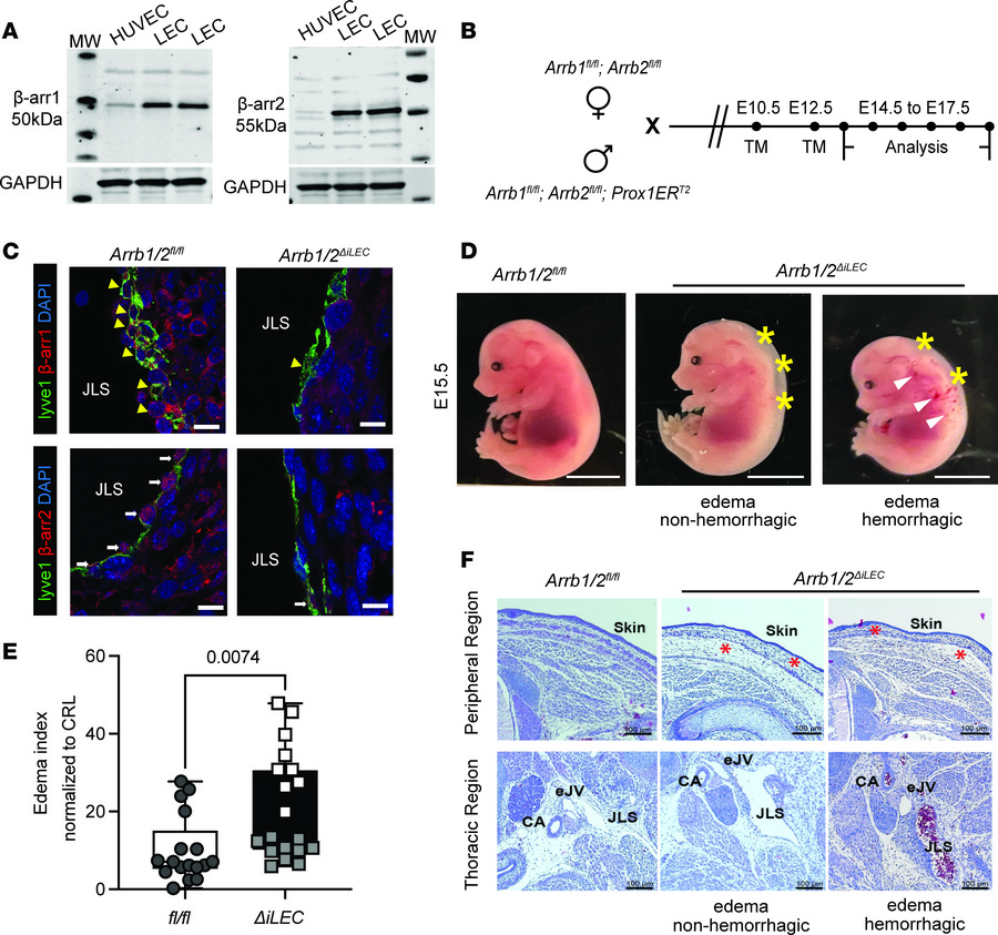 Hydrops fetalis in Arrb1/2ΔiLEC embryos compared with Arrb1/2fl/fl.
(A) ...