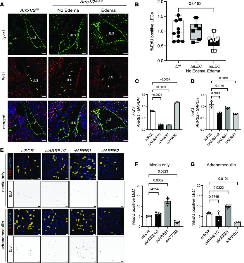 Lymphatic loss of Arrb1/2 causes decreased proliferation of the jugular ...