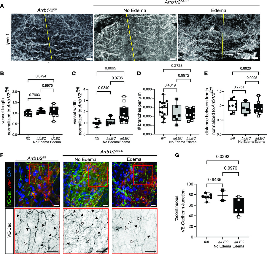 Dorsal dermal lymphatic vessels are dilated in Arrb1/2ΔiLEC embryos.
(A)...