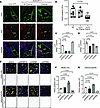 Lymphatic loss of Arrb1/2 causes decreased proliferation of the jugular lym