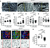 Dorsal dermal lymphatic vessels are dilated in Arrb1/2ΔiLEC embryos.