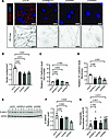 Diminished VE-cadherin adherens junctions in the membrane of LECs cause los