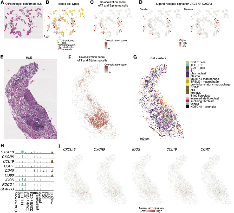 Identification and characterization of tertiary lymphoid structures (TLS...