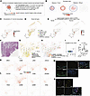 Colocalization score framework pinpoints interactions of T cells and macrop